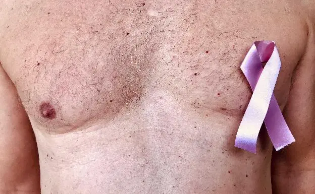 El riesgo de cáncer de mama en los hombres aumenta con la edad.