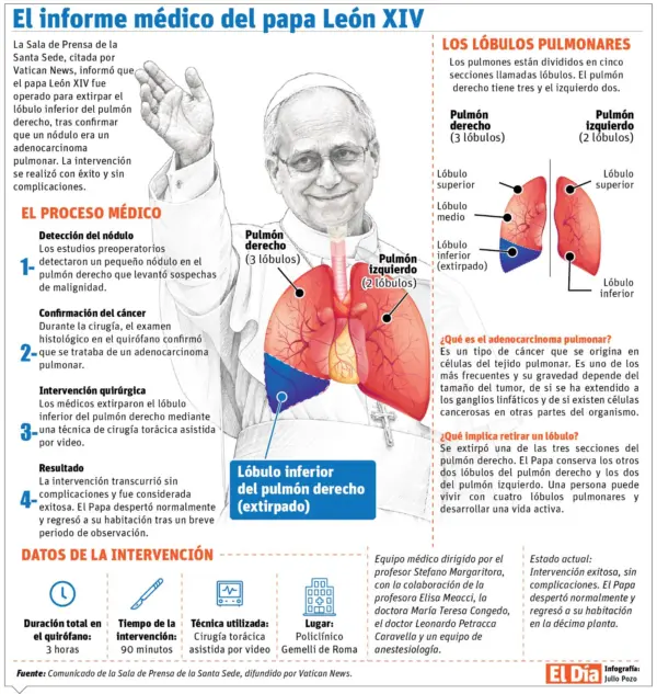 info-SALUD PAPA XIV